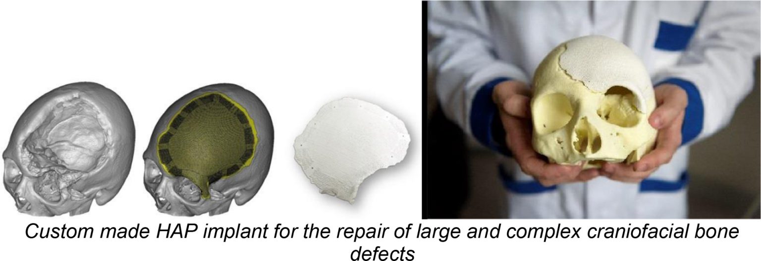 Additive Manufacturing of Ceramics for Biomedical Applications Sinto